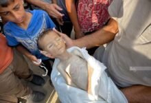 18 Die of Hunger in Gaza Within 24 Hours A Living Proof of Genocide