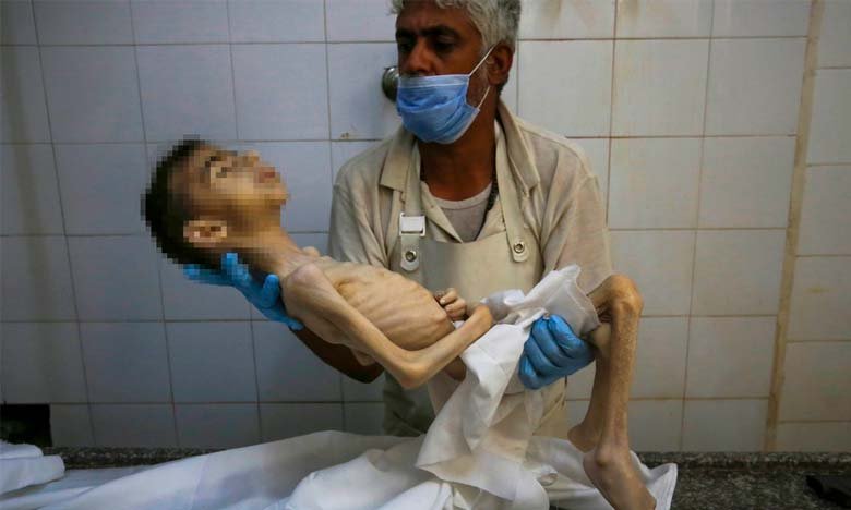 Palestinians Trapped in Gazas Famine World Remains Silent While Genocide Continues